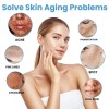Cara Crema para Manchas Oscuras en La Cara, Cremas Quitar