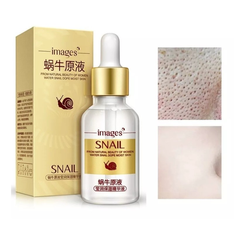Images Serum Facial Suave Caracol Vitamina C Cierra Poros Aclara