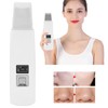 Rechargeable Ultrasonic Skin Scrubber Blackhead Removal Face Pore Cleaner Instrument
