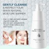 Leche Limpiadora Suave Y Eliminadora De Puntos Negros P Mois