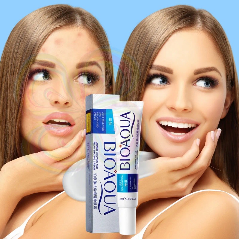 🔥 Bioaqua pure skin set antiacné 4 piezas sérum crema