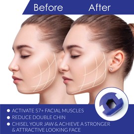Temmel Jaw Exerciser - Jawline Exerciser with Neck Rope - Define Your Jawline, Slim and Tone Your Face & Neck Muscles to Look Younger – Jaw Exerciser for Men and Women (Purple)