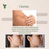 Extraherbos Pomada de Neem 100% Natural, 30g - Para cicatrices