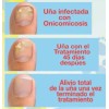 Fungicida P/ Uñas C/ Hongos, Negras, Amarilla U Onicomicosis