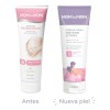 Mom Etapa Prevenir Estrías Aceite Comezón Neutra