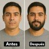 Kit Unidades Balsamo Crecer Barba Cítrica
