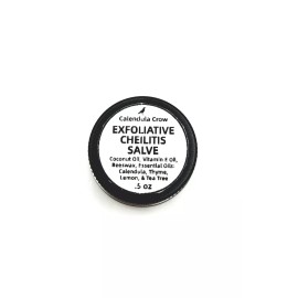 calendula crow Exfoliative Cheilitis Salve - Lip Balm .5 oz