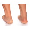 Advanced Clinicals Cracked Heel Cream For Dry Feet, Rough Spots,