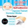 CHEMAILON Professional Ingrown Toenail Correction Kit - Stainless Steel Ingrown