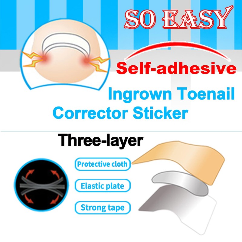 CHEMAILON Professional Ingrown Toenail Correction Kit - Stainless Steel Ingrown