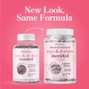Myo Inositol Chiro Equilibrio Hormonal Femenino Ratio Apoyo Salud Ovárica