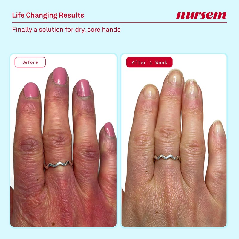 Nursem Caring Hand Cream - 75ml, Fast-Absorbing Moisturising Hand Cream