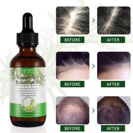 Rosemary Oil Hair Pack of 2, Rosemary Oil for Hair, 60 ml, 100% Pure Natural Rosemary Oil, Stimulates Hair Growth and Against Hair Loss, Rosemary Oil for Men and Women