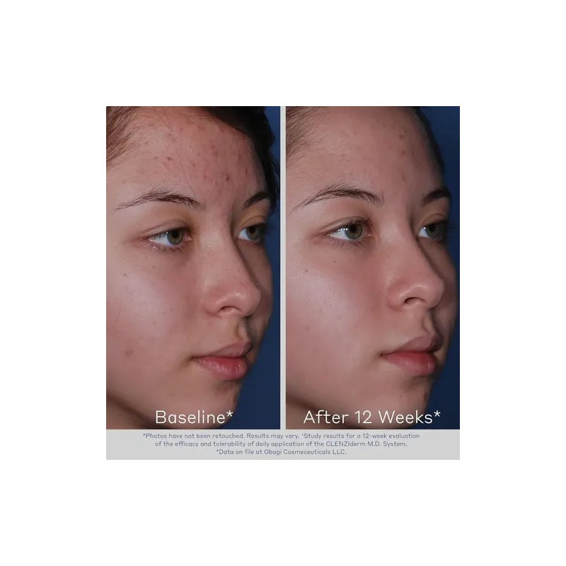 Limpiador Espumoso Facial Obagi Clenziderm M.d. 2% Ácido Sal