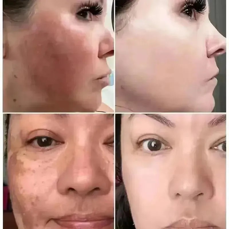 Sérum De Vitamina C, 3 Unidades, Iluminador Antiarrugas Ch