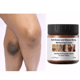 MOOYAM New Strong Whitening Cream For Removing Dark Knuckle Finger Elbow and Knee USA