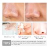 Serum Facial Lanbena Reduce Poros Espinillas Acné Hidratante