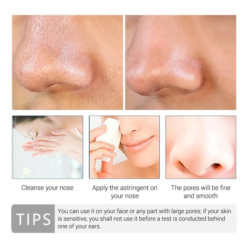 Serum Facial Lanbena Reduce Poros Espinillas Acné Hidratante