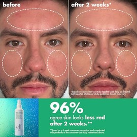 e.l.f. SKIN Save Your Hipoclorous Mist, spray facial desarrollado por dermatólogos, alivia y calma el enrojecimiento, piel sensible y propensa a manch