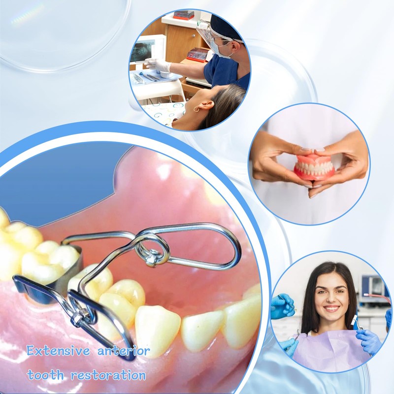 30 Piece Dental Anterior Matrix Kit with Proximal Strips and