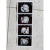 Prank 3D Customized Fake Ultrasound Strip of 4 Photos