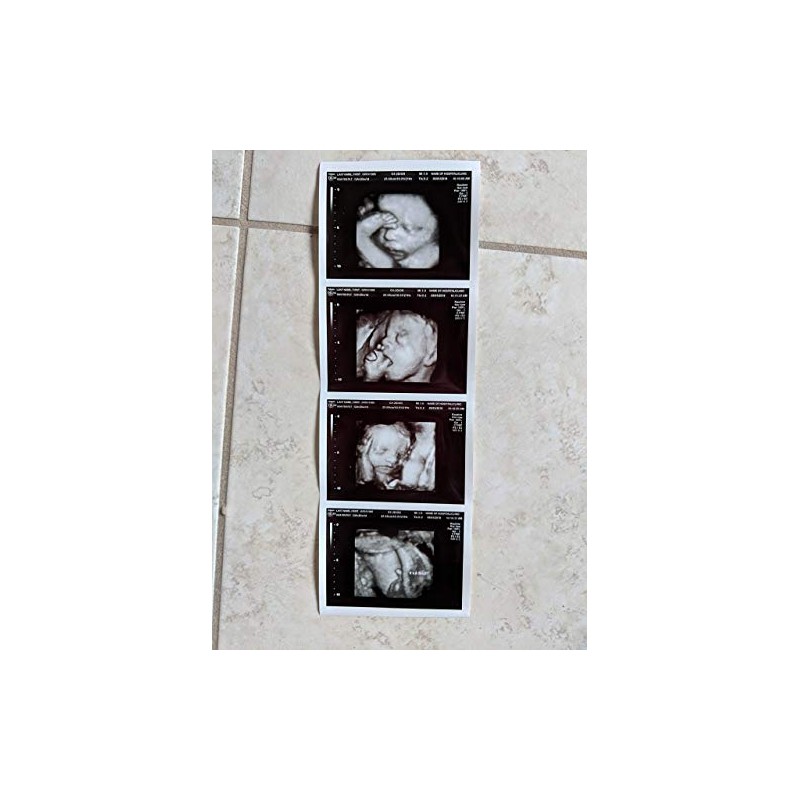 Prank 3D Customized Fake Ultrasound Strip of 4 Photos