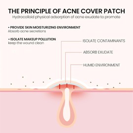 Parches para Espinillas y Acné, para Piel Grasa Mixta o con Imperfecciones Cuidado de Piel con Imperfecciones, Elimina Espinillas, Cubre Manchas, Absorbe Grasa y Trata Rápidamente, 200 Piezas
