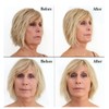 Bring It Up Instant Neck Lift Tape 30 Day Supply,