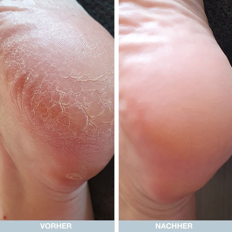 Foot Kit (Bundle)