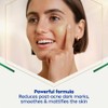 NIVEA Luminous 630 Post-Acne Dark Marks Serum (30ml), Facial Serum