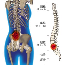 Cyprus Doctor Tour Lumbar Corset (M Size) 6 Arch Bones, Double Belt to Support Lumbar Muscles
