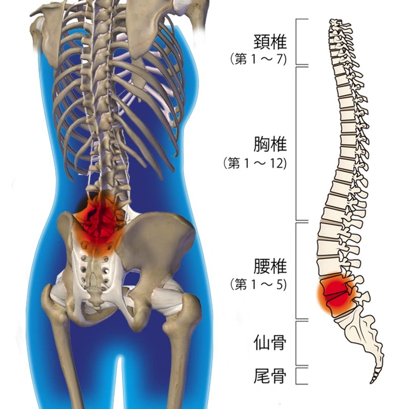 Cyprus Doctor Tour Lumbar Corset (M Size) 6 Arch Bones,