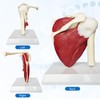 Human Shoulder Joint Model with Muscle Anatomical Model for Medical