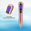 LED Freckle Skin Spots Mole Tattoo Removal Pen Beauty Skin