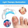 Dispositivo Ligero Para Hongos En Las Uñas De Los Pies