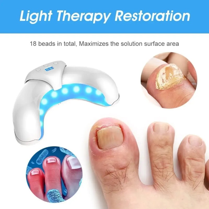 Dispositivo Ligero Para Hongos En Las Uñas De Los Pies