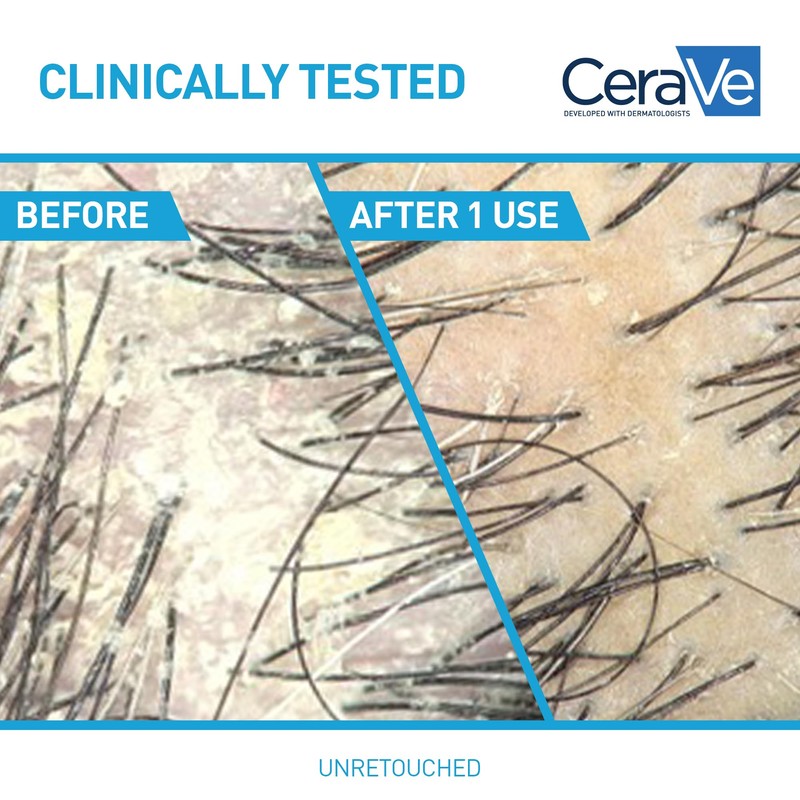 CeraVe Anti Dandruff Hydrating Conditioner, Leaves Hair Soft, Nourished &
