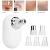 Electric Facial Pore Cleansing Remove Blackhead Acne Vacuum Suction Instrument
