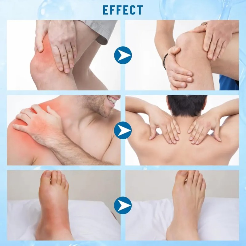 Pack De 2 Cremas Para El Alivio De La Neuropatía,