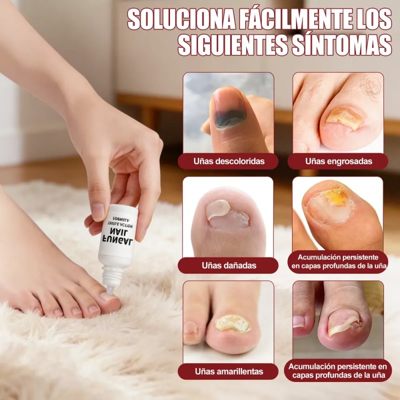 Tratamiento Para Uñas 15 Ml X2 Solución Para Cuidado De