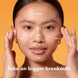 Mighty Patch Hero Cosmetics Face Patch - XL Hydrocolloid Face Mask for Acne, 5 Large Pimple Patches for Zit Breakouts on Nose, Chin, Forehead & Cheeks (1 Count)