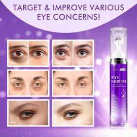 15 ml Eye Contour Serum with 8% Caffeine, for Dark Circles & Puffiness, Wrinkles & Fine Lines, Anti-Wrinkles, Anti-Pockets & Concealer, Pure Hyaluronic Acid & Caffeine for Women and Men (Pack of 1)