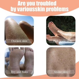 2Pcs Strawberry Skin Treatment,Strawberry Legs Resurfacing Cream For Women,Advanced Triple-Acid Complex,Helps Reduce Chicken Skin Bumps,Exfoliating Body Cream With Deep Hydration.