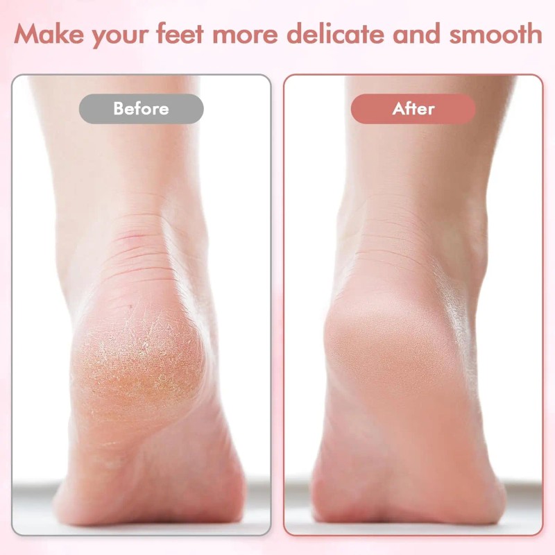 / Mini Electric Foot Callus Remover, Portable Rechargeable Pedicure Tool,