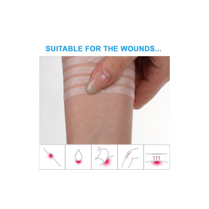 Wound Closure Strips, Pack of 50, Staple Plaster Strips, Skin