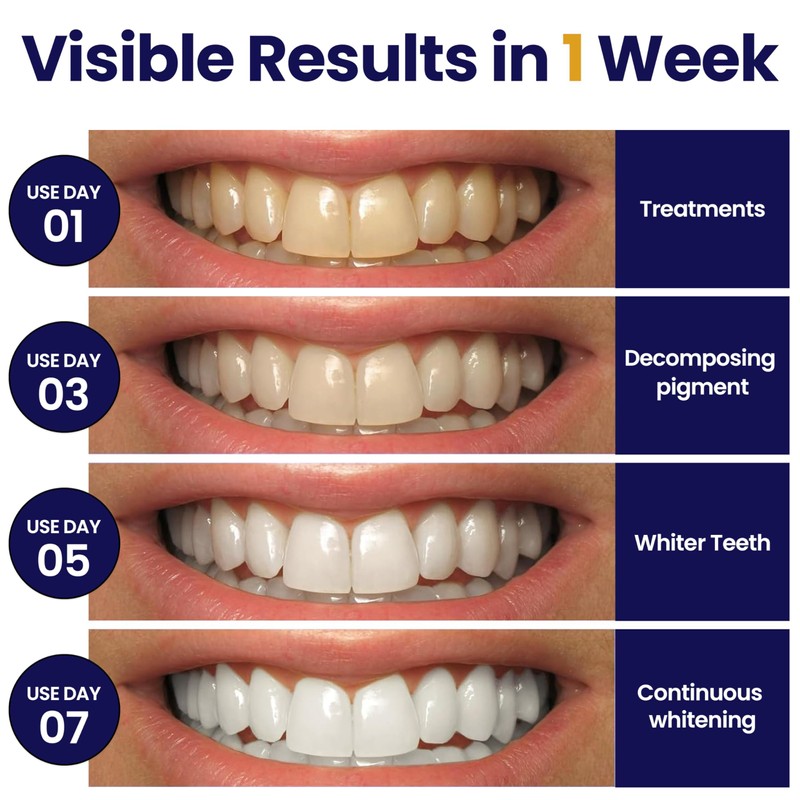 DENTELO Professional Teeth Whitening Strips,42 Non-Sensitive, Safe for Enamel, Anti