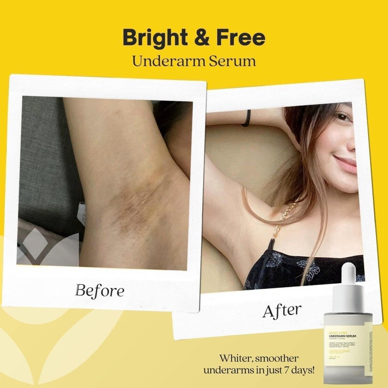 Catt & Co Bright & Free Underarm Serum, 30ml