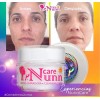 Nunn Care 1 Crema Limpiadora 100% Original