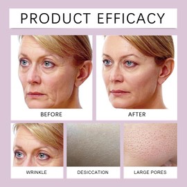 Bio Real Deep Lifting Mask,Collagen Face Masks Skincare Sheet for Woman,3D L/ifting C/ollagen Full Face Tension Gel M/ask,Deep Co/llagen Anti Wrinkle Lifting Ma/sk,Overnight Collagen Fa/ce Mask