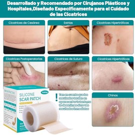 Yakiter 2M4CM Parches de Silicona para Cicatrices,Cinta para Cicatrices Recortable,Impermeable y Reutilizable,Adecuado para Cesreas,Eliminacin de...  